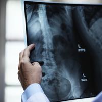 A physician holding up a back xray